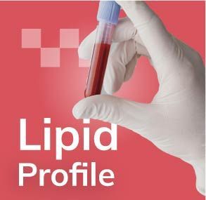 Lipid Test: 5 Important Questions Answered