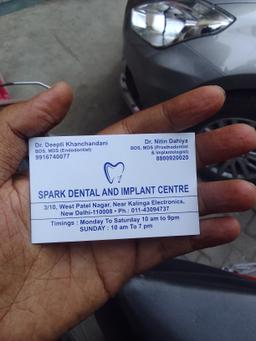 Spark Dental & Implant Center, Market, Central Delhi image-4