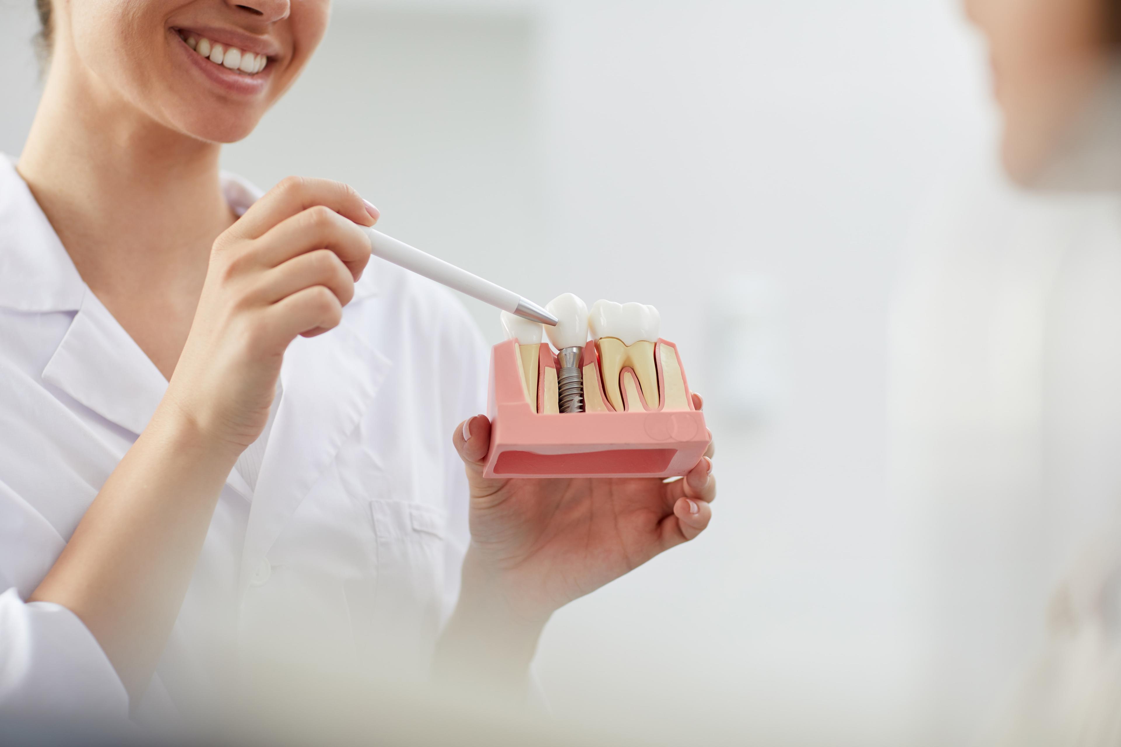 Dental Implants: Problems, Types, and Benefits