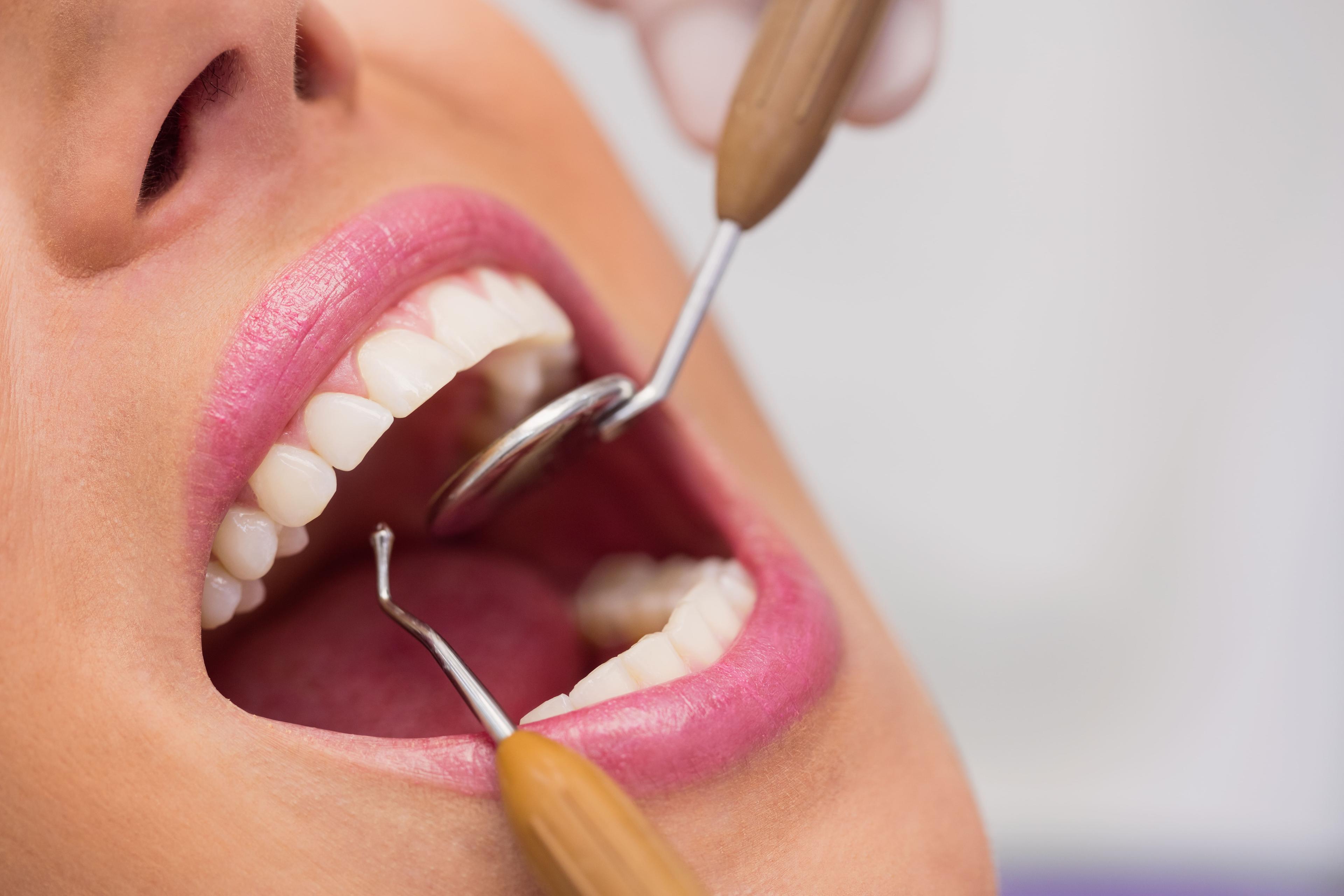 A Simple Guide to Understanding Orthodontic Treatments