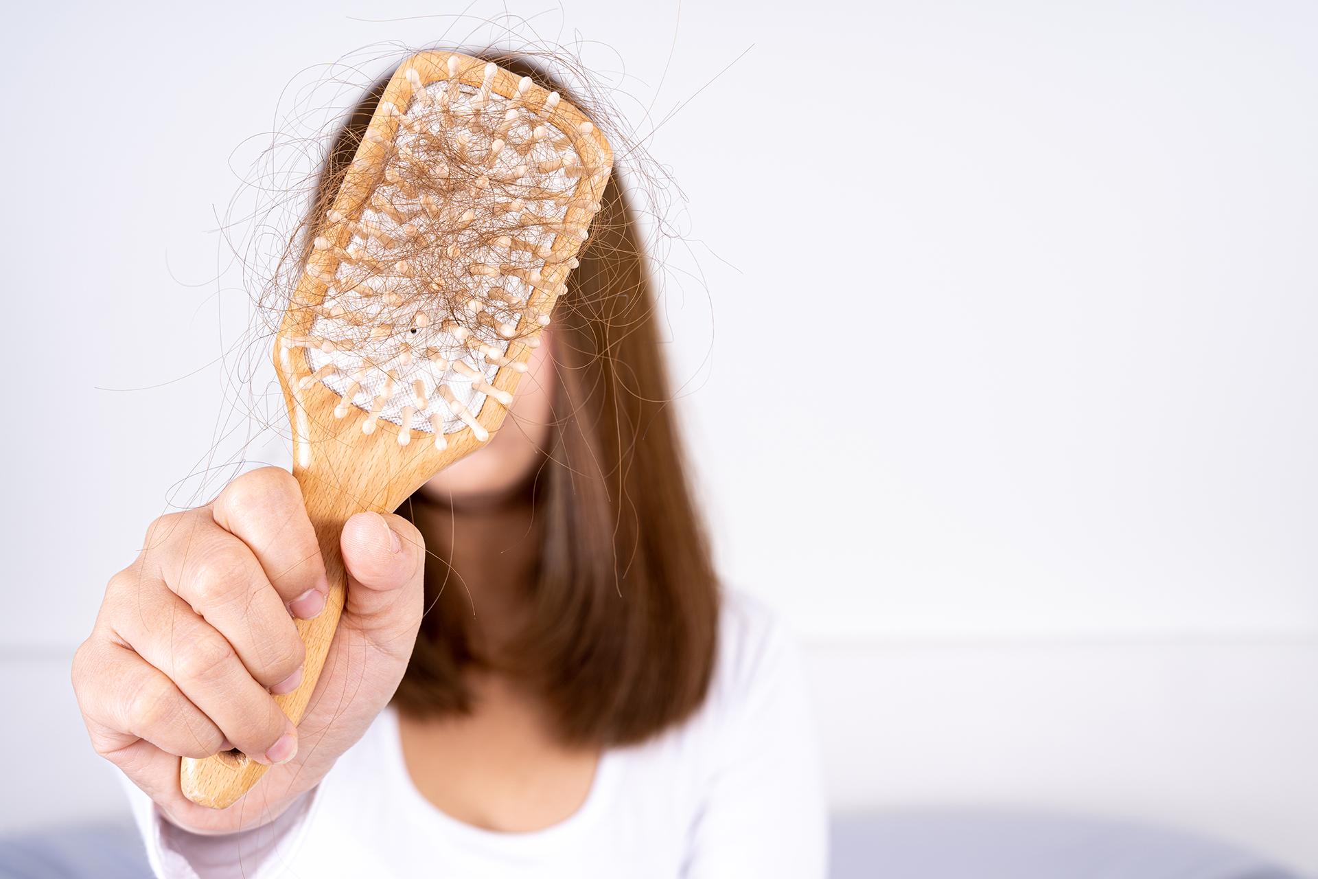PCOS केस गळणे: कारणे, उपचार आणि घरगुती उपाय