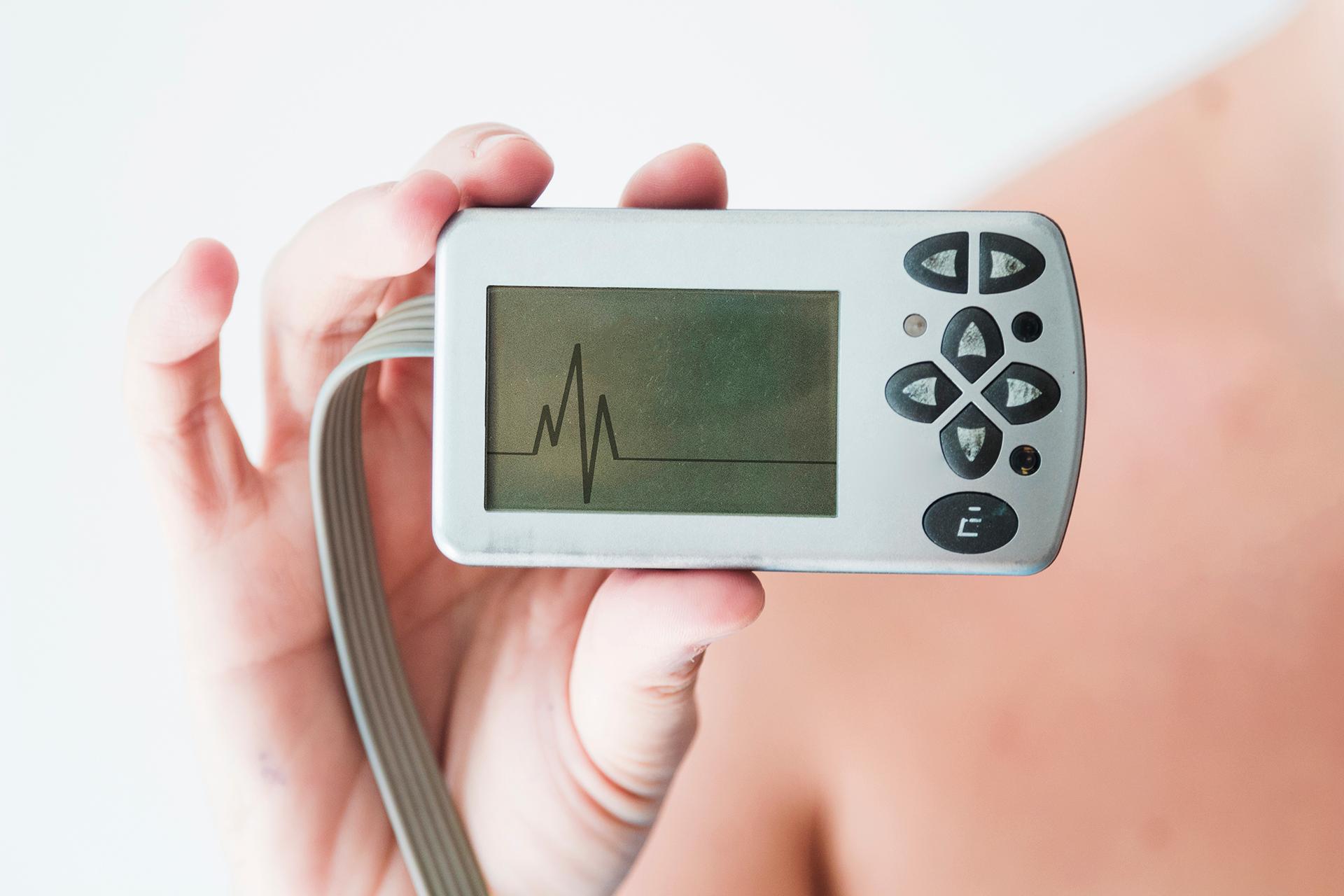 ECG Test: How Effective it is in Detecting Heart Blockage?