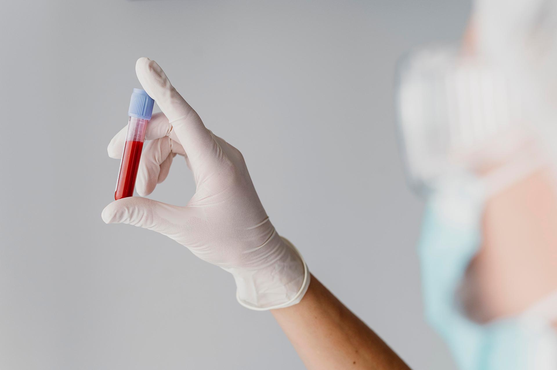 Blood Group Test: How it is Done and What are the Different Blood Types?