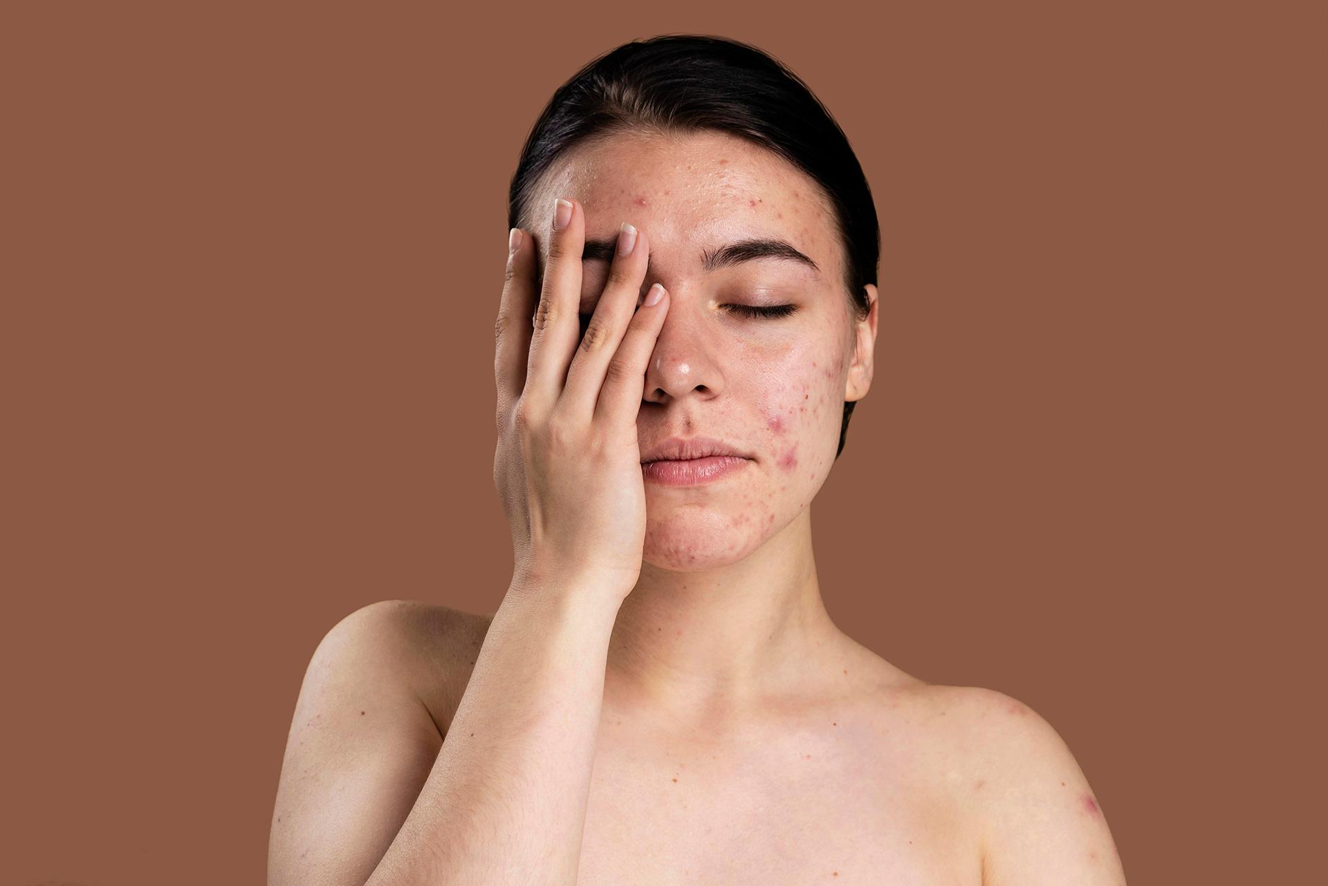 Contact Dermatitis: Types and Effective Tips for Treatment!