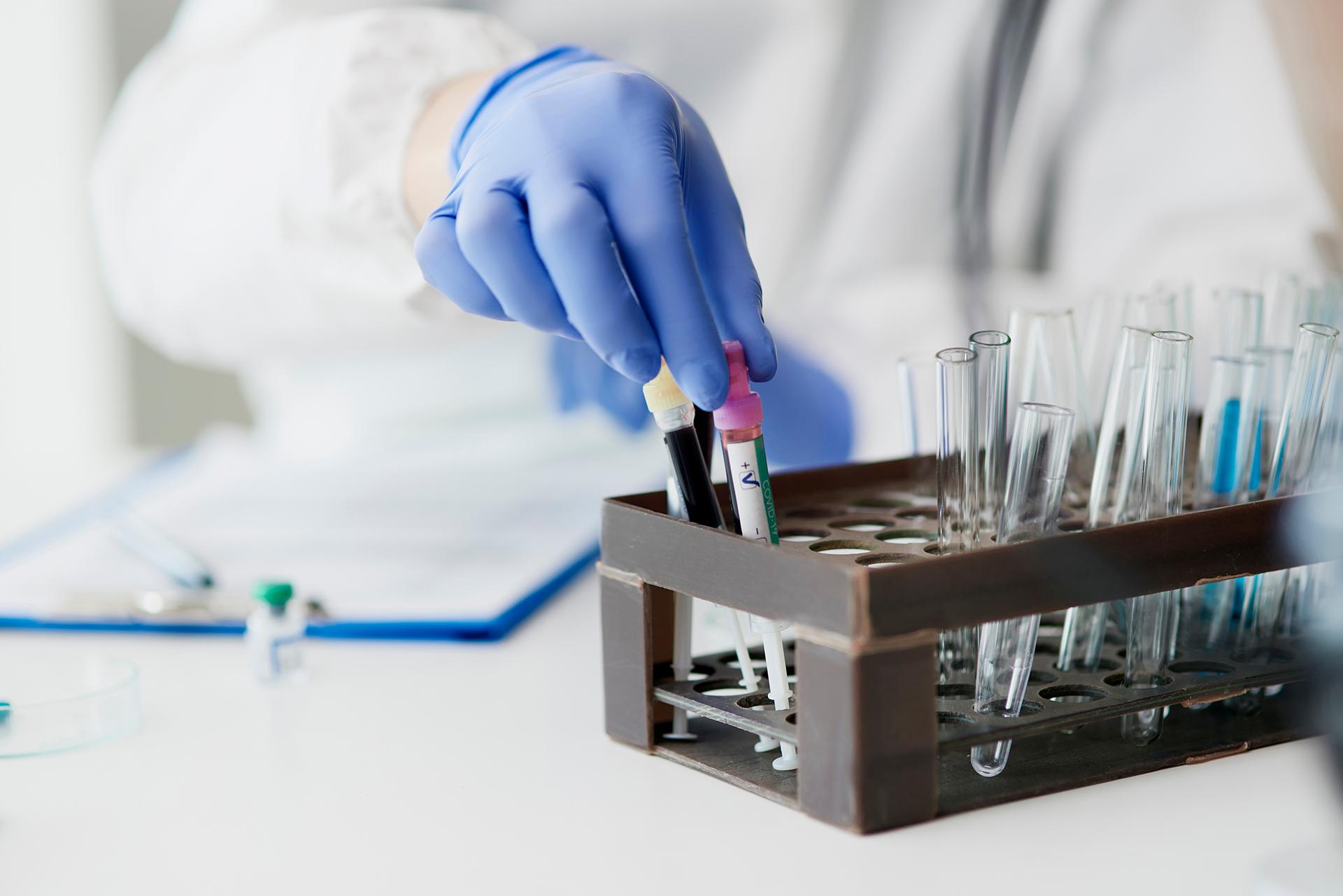 Ways to Get Lab Test Reimbursement with Health Protect Plans