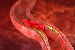 Cholesterol Normal Range: Top Things You Must Know