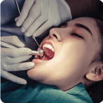 क्रॅक दात लक्षणे, कारणे, प्रकार आणि गुंतागुंत