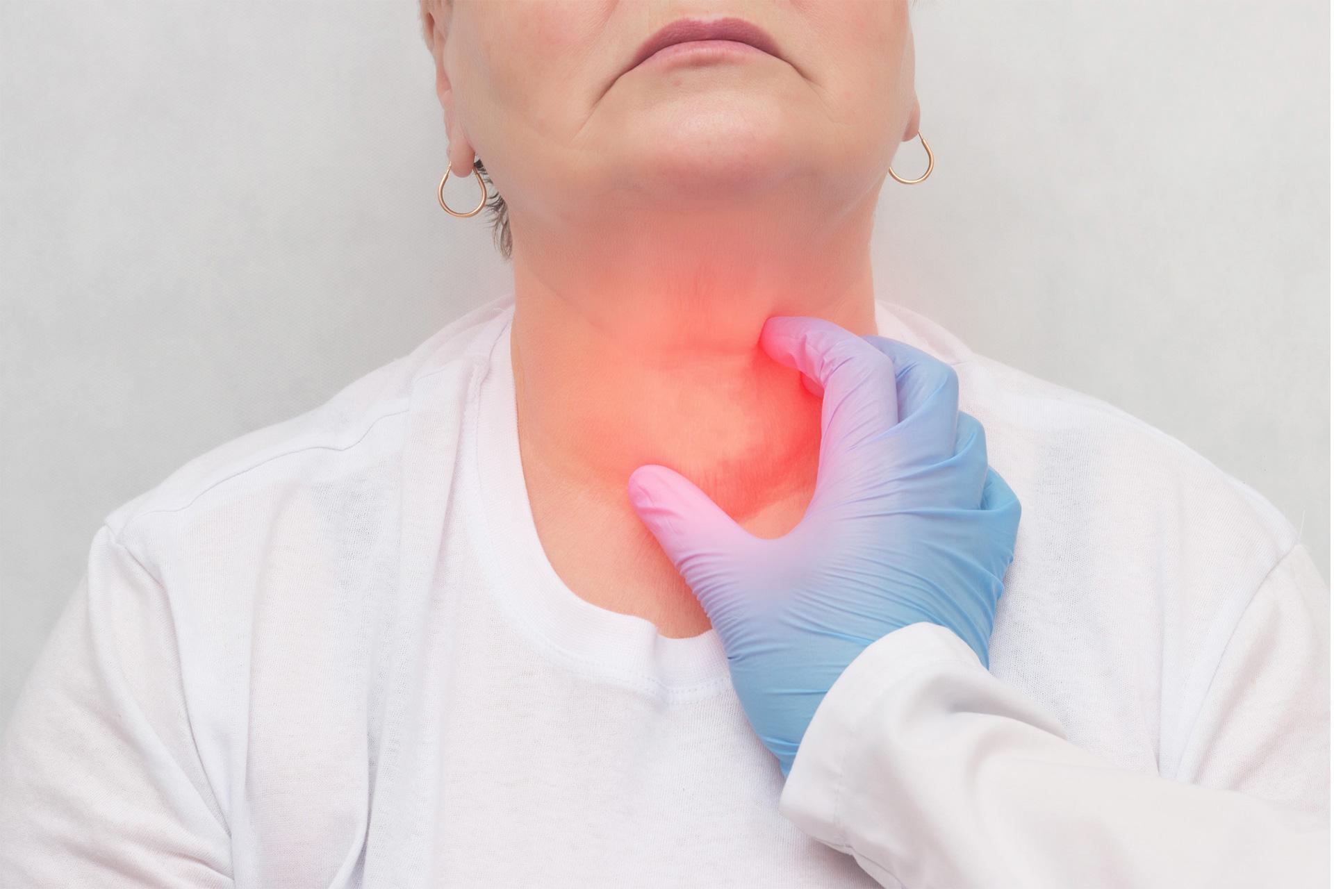 Goiter: Causes, Symptoms,Types and Treatment
