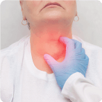 Goiter: Causes, Symptoms,Types and Treatment