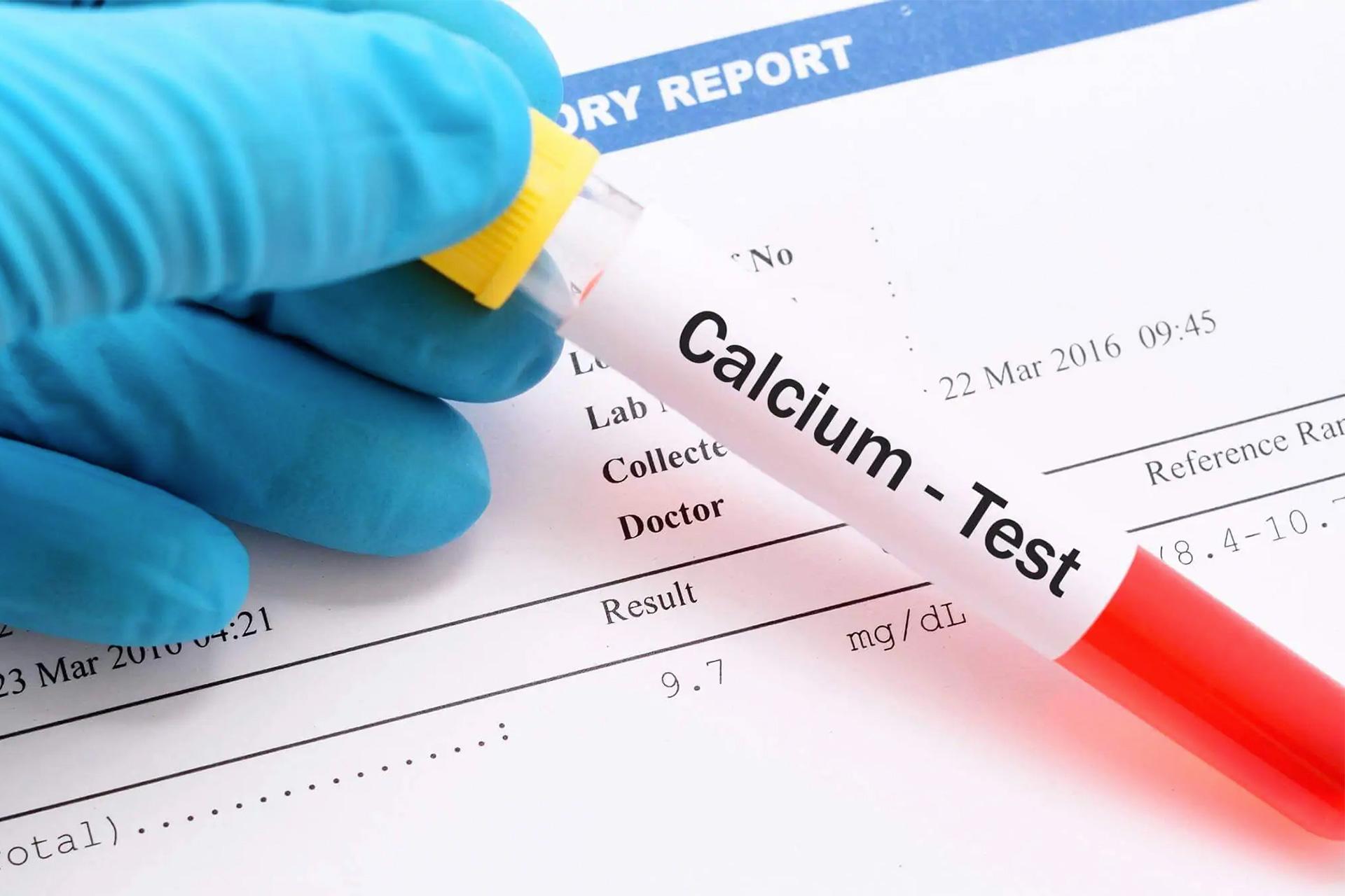 Calcium Blood Test: Procedure, Normal Range and Results