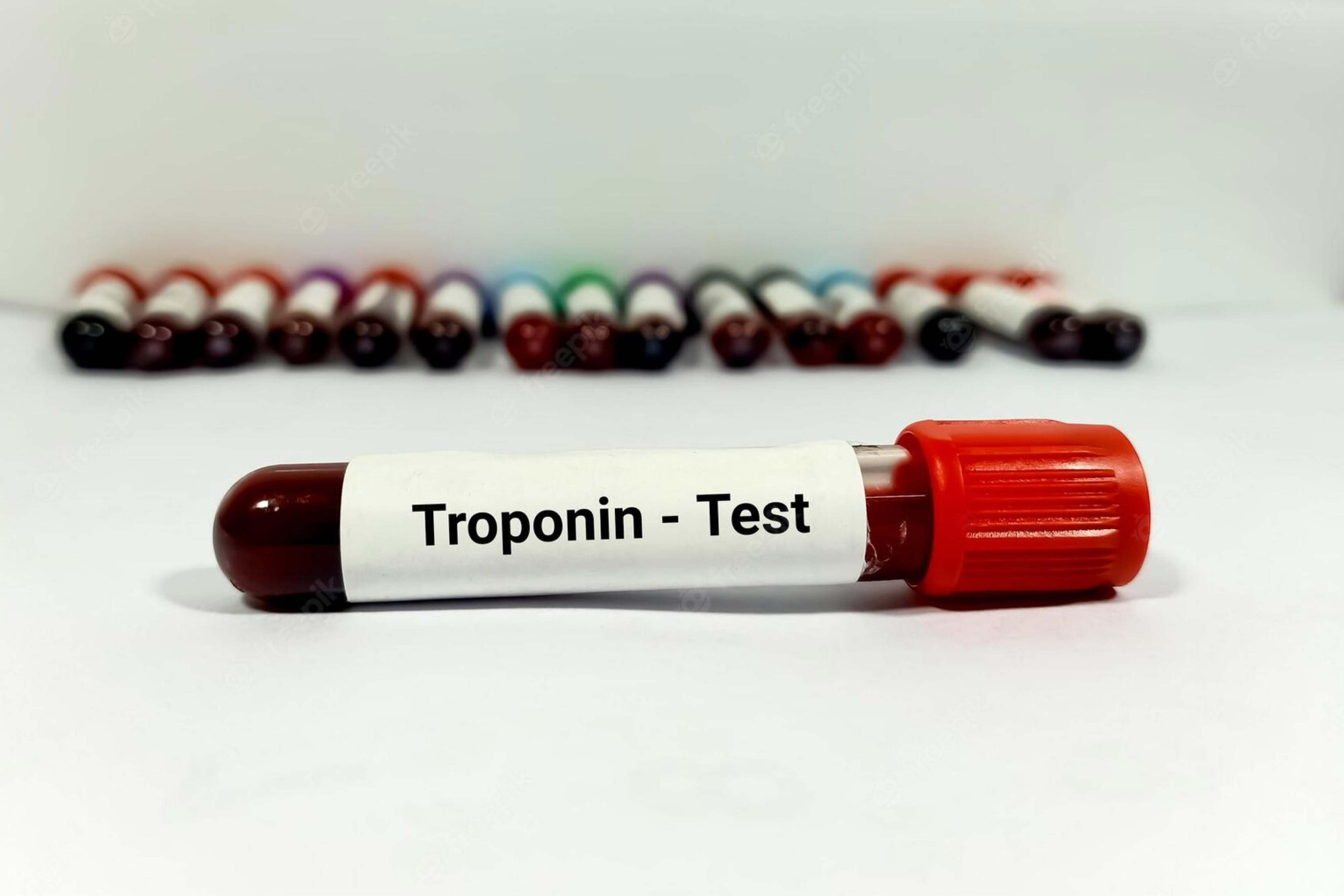 ट्रोपोनिन परीक्षण: यह क्या है, सामान्य सीमा और उच्च स्तरीय कारण