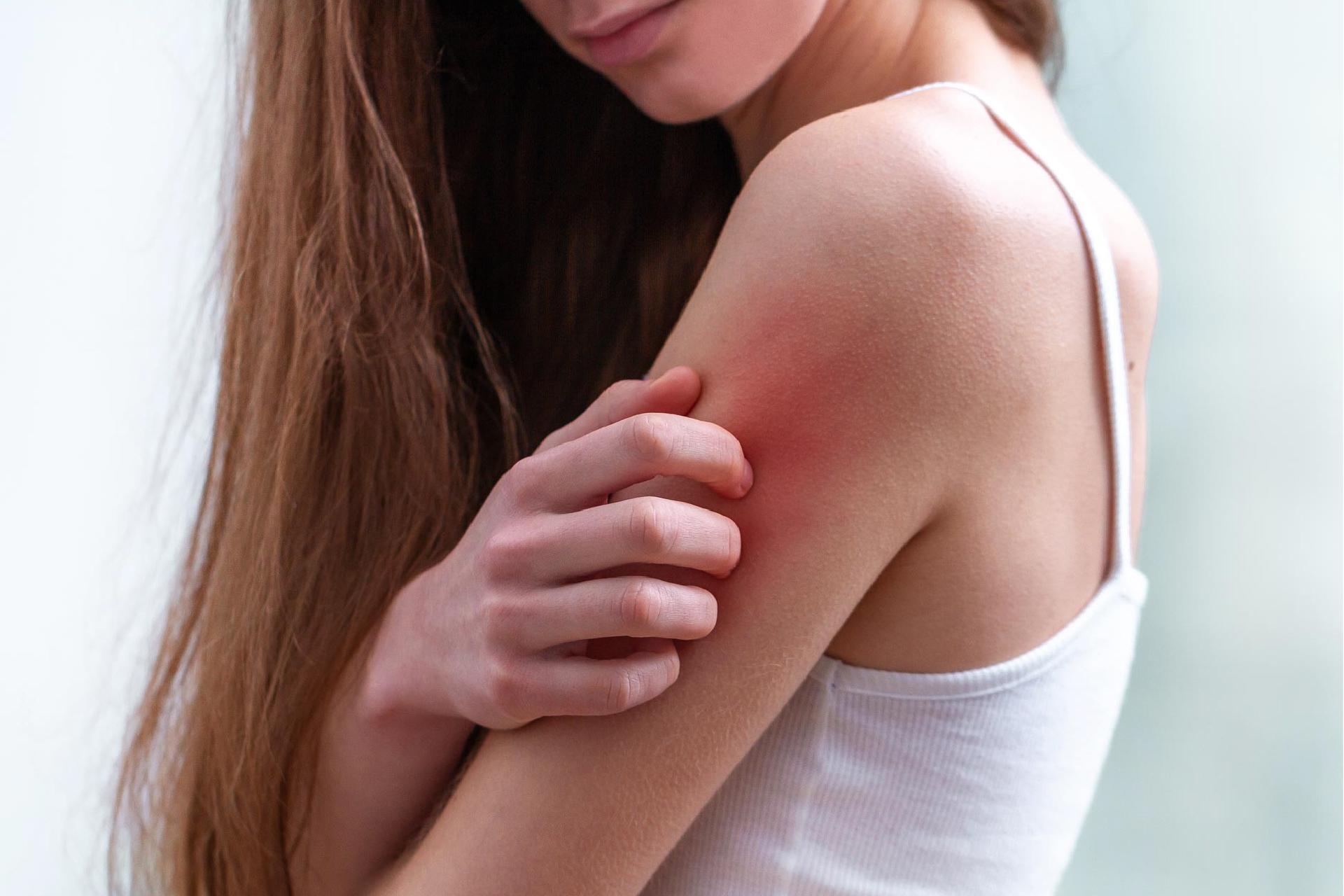 Five Fall Season Skin Problems to Look Out for This Season