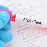Antinuclear Antibodies Blood Test: Purpose, Risks, Results