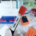 What Does VDRL Test Means, Procedure, Results