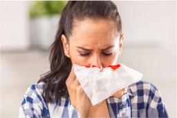 How to Stop a Nosebleed: Causes, Preventions and Remedies