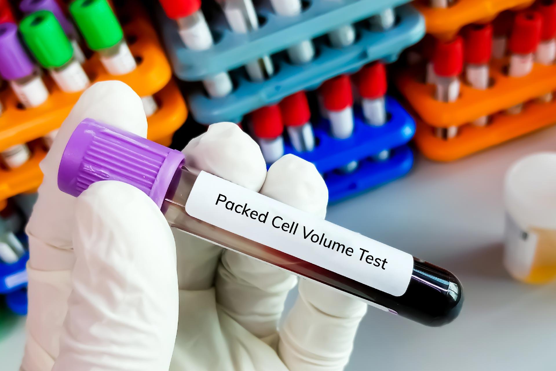 PCV(Packed Cell Volume) Test Normal Range: A Detailed Guide