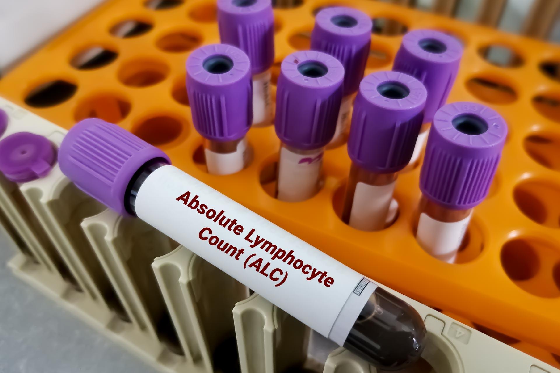 Absolute Lymphocyte Count Normal Range Indicates Good Health