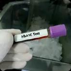 HbA1c সাধারণ পরিসর: HbA1c টেস্টের মাধ্যমে ডায়াবেটিস স্ক্যান করতে হয়
