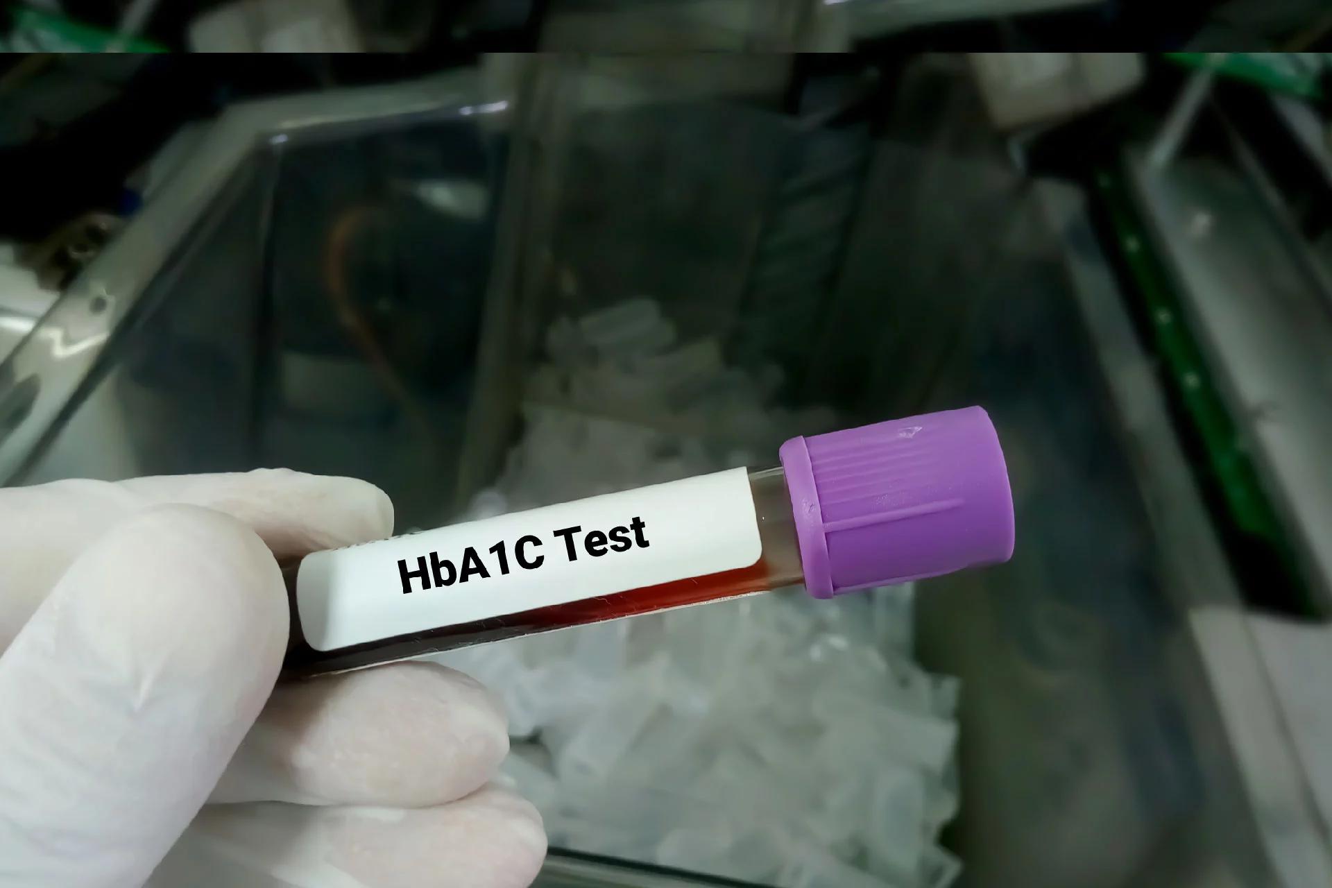 HbA1c सामान्य श्रेणी: HbA1c चाचणीसह मधुमेह कसे स्कॅन करावे