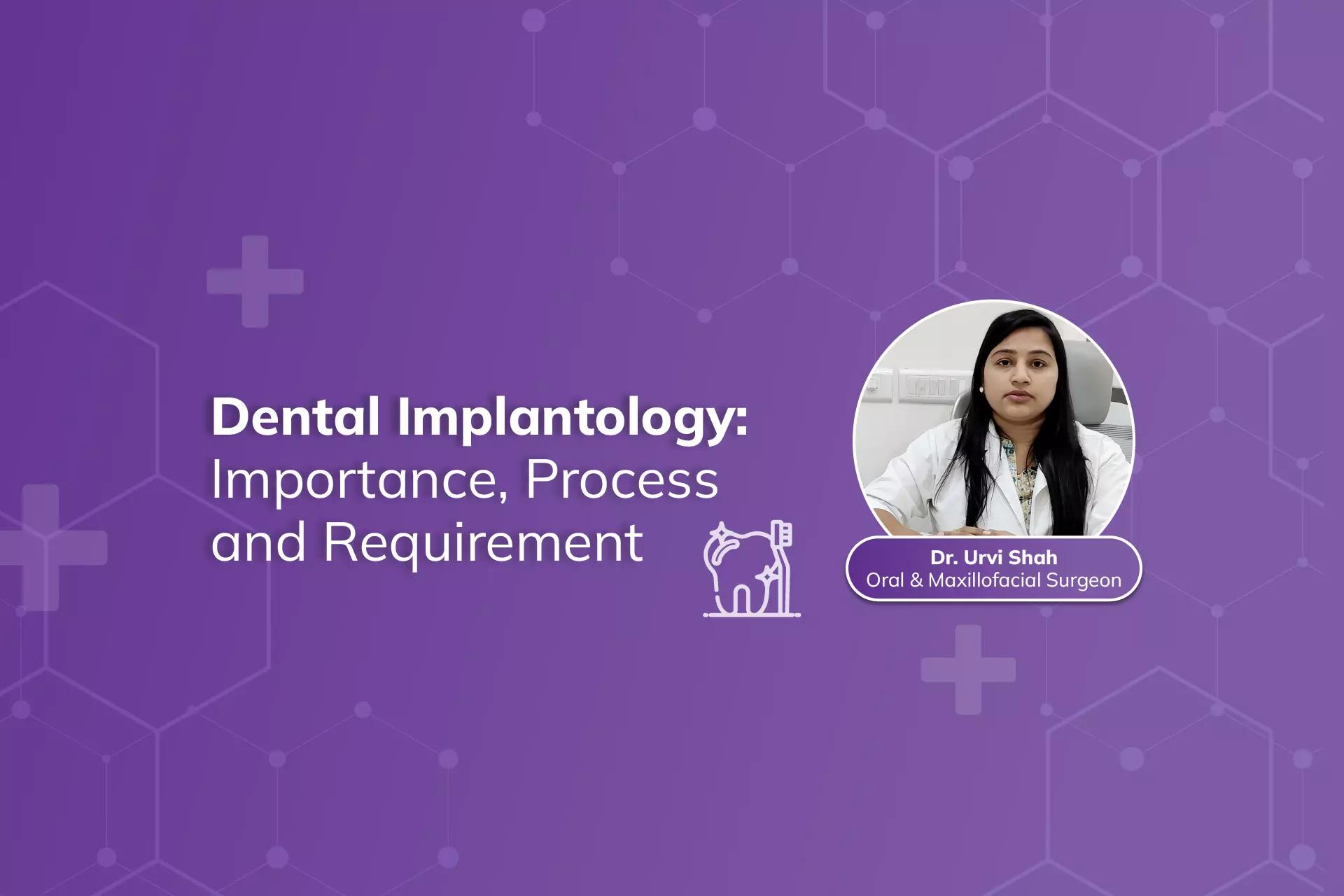 Dental Implantology: Importance and Process by Dr. Urvi Shah