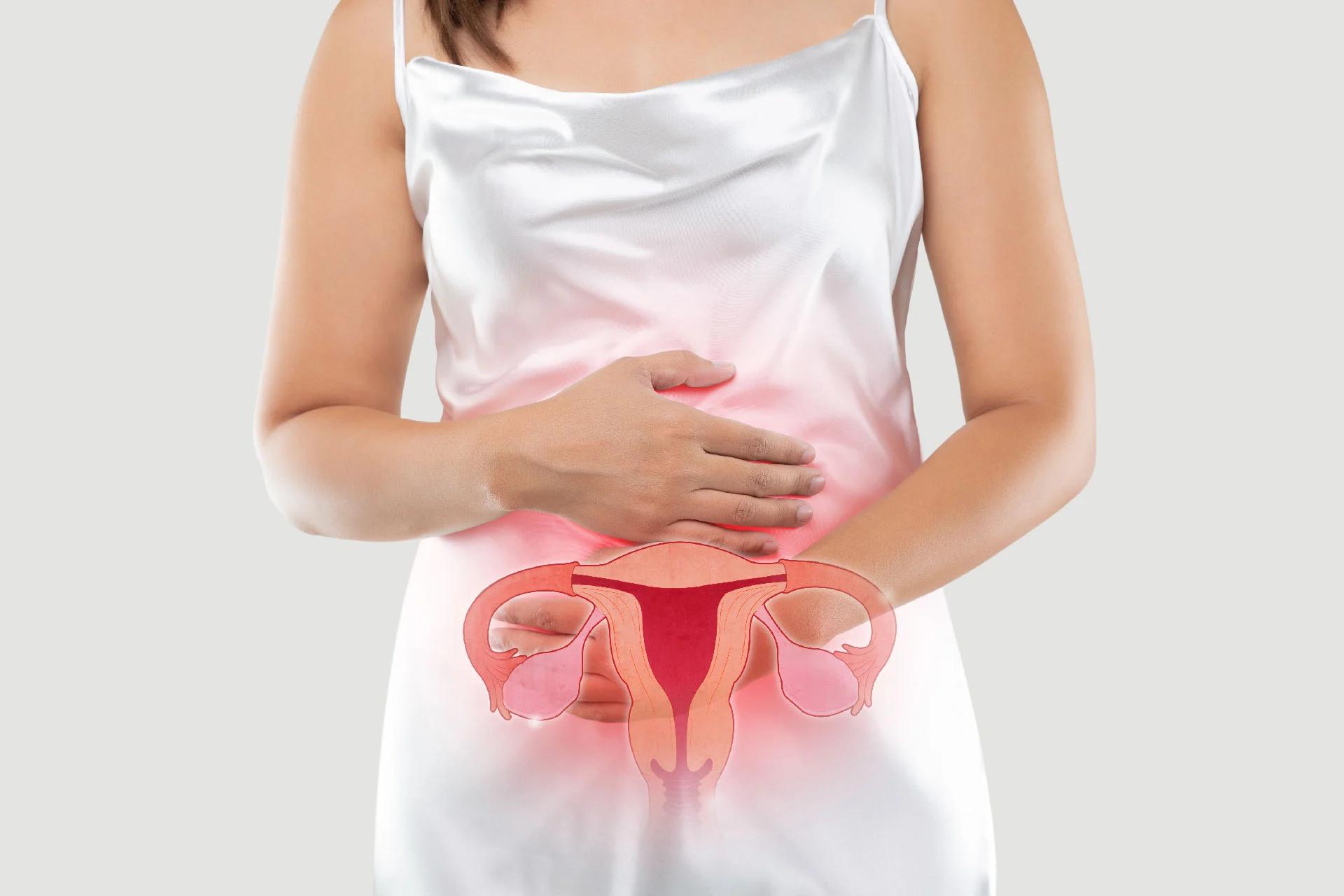 Top 10 Home Remedies to Manage PCOS Permanently