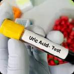 Uric Acid Normal Range: Top Questions About Uric Acid Levels and More