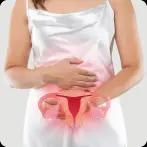 Top 10 Home Remedies to Manage PCOS Permanently